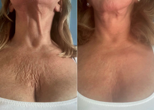 Customer testimonial