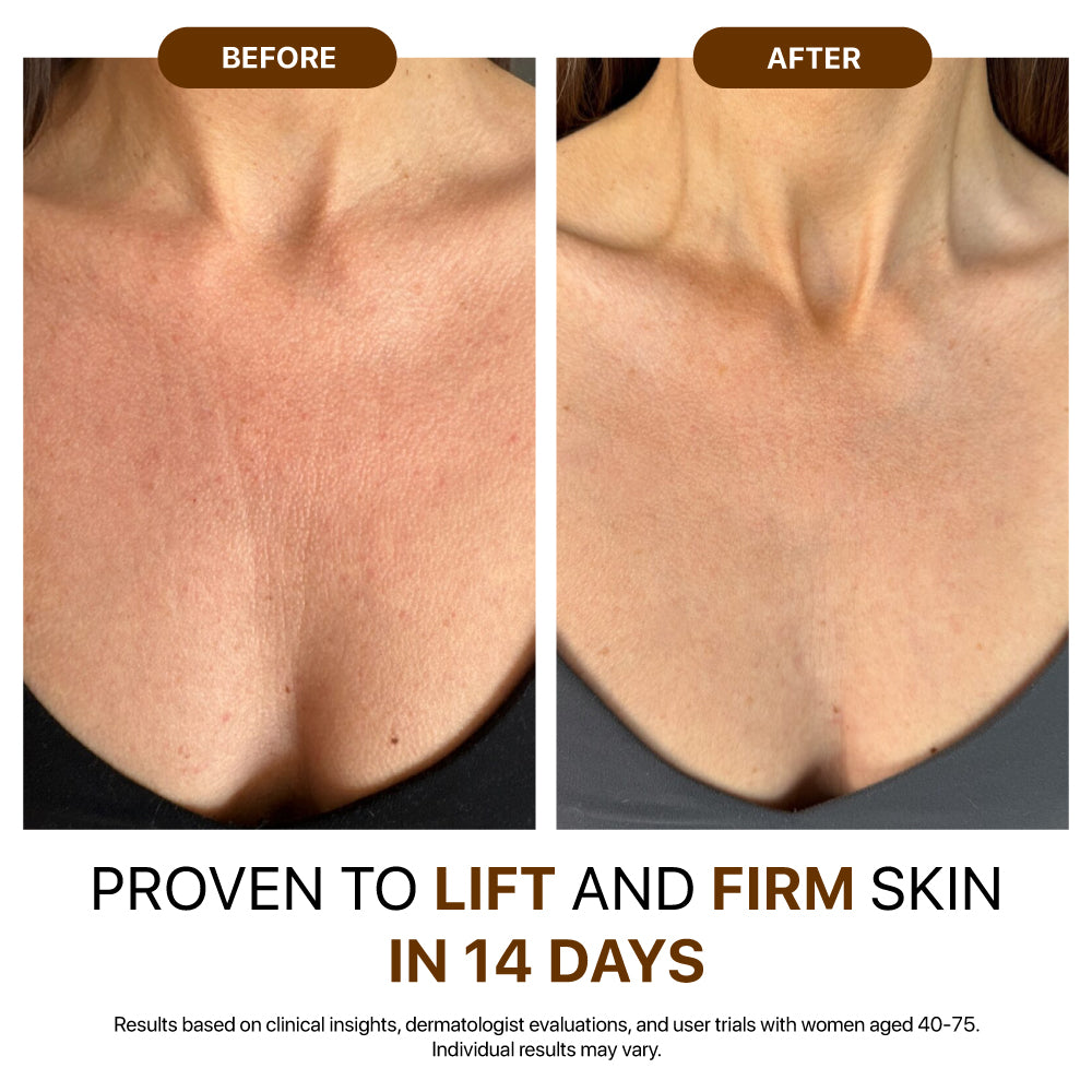 It's Formulated For Lipid-Starved Skin <span> (Not Normal Dryness)</span>